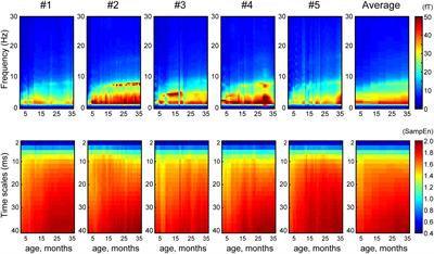 Developmental Trajectory of Infant Brain Signal Variability: A Longitudinal Pilot Study